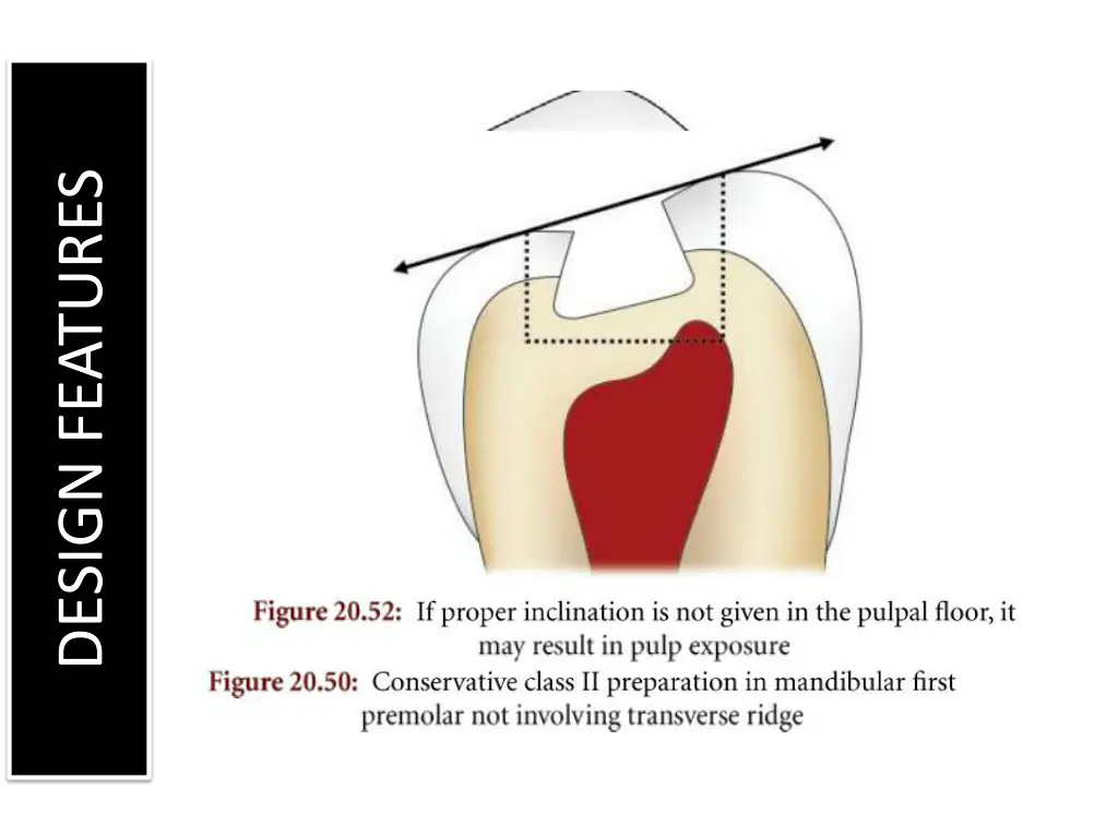 design features 2