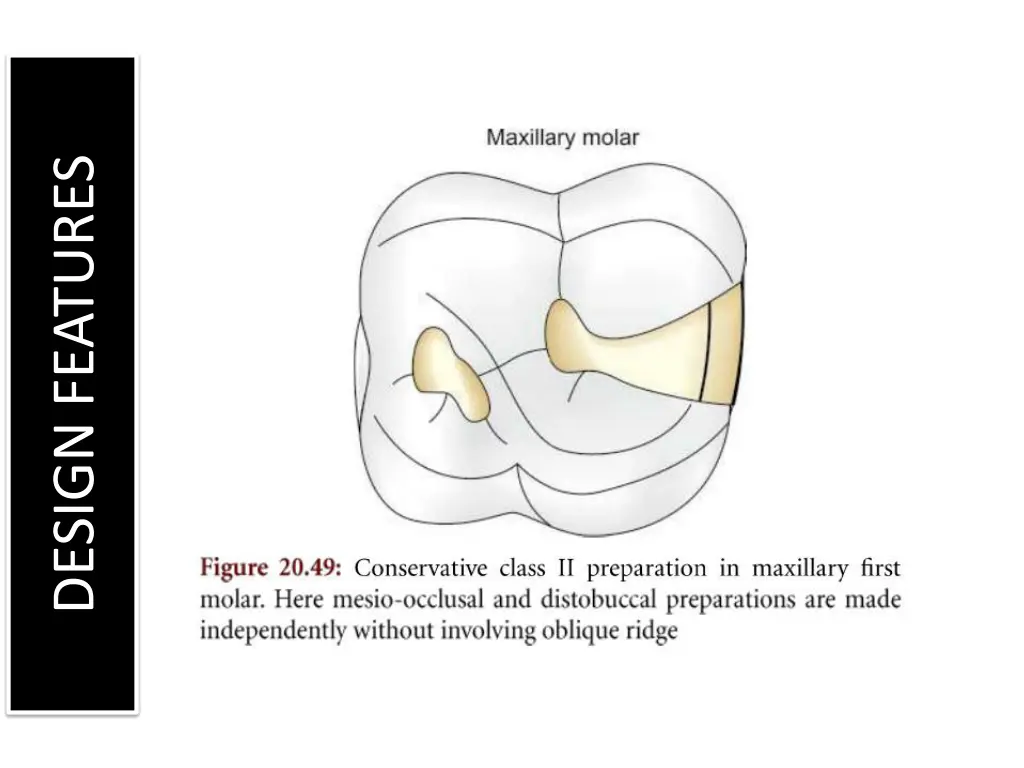 design features 3