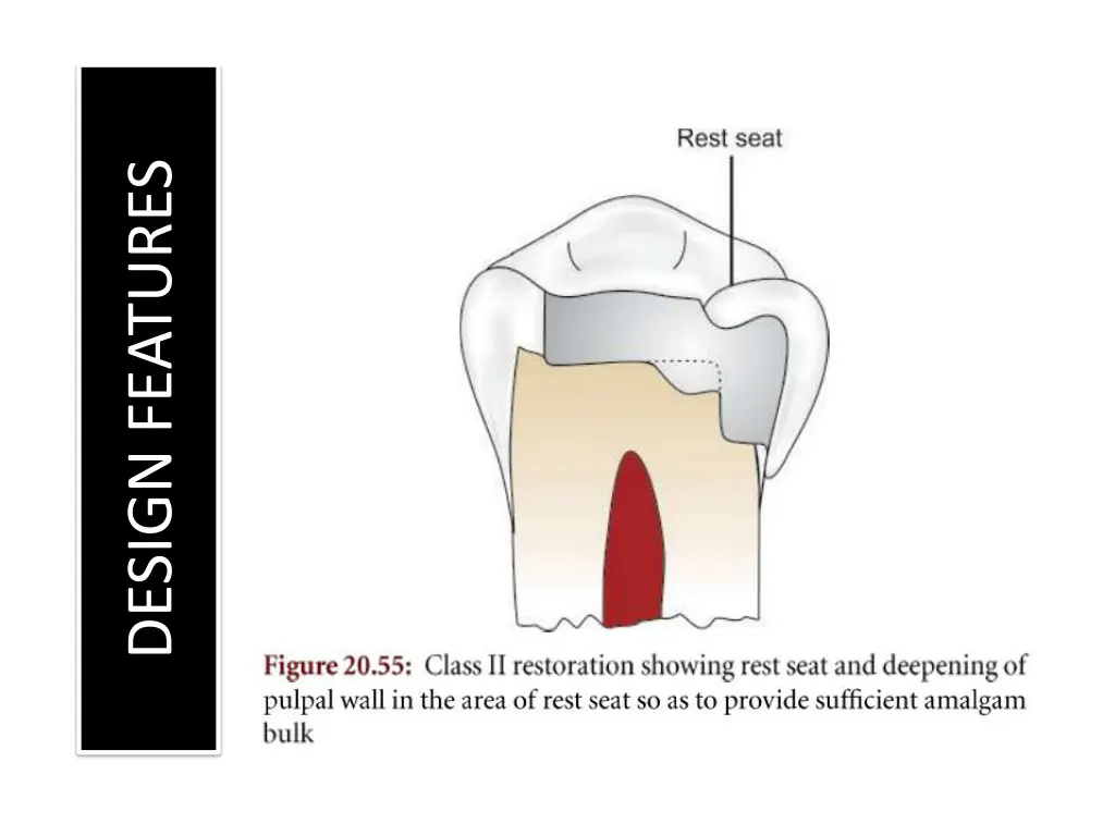 design features 4