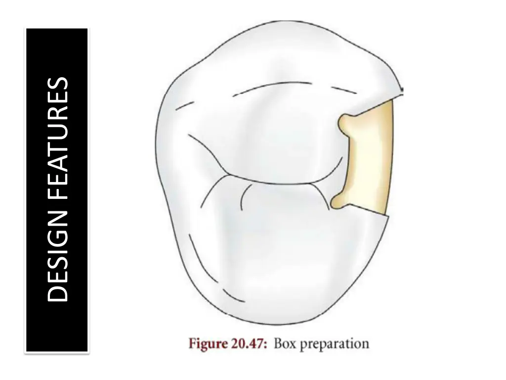 design features