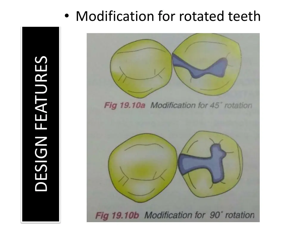 modification for rotated teeth
