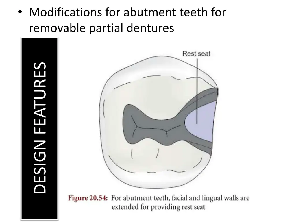 modifications for abutment teeth for removable