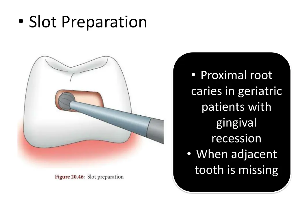 slot preparation