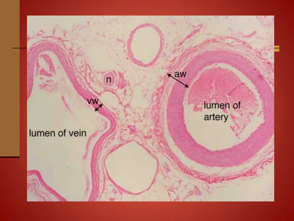 slide5