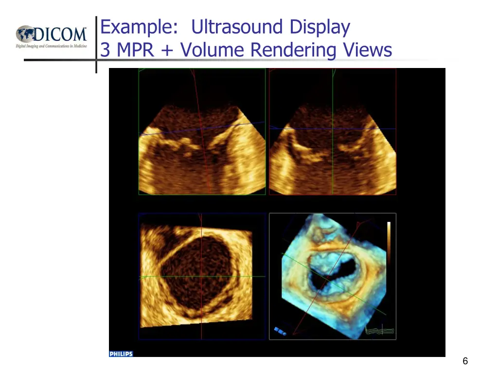 example ultrasound display 3 mpr volume rendering