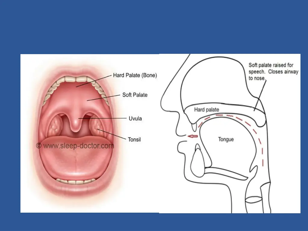 slide16