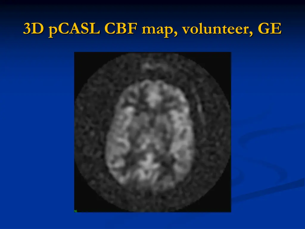3d pcasl cbf map volunteer ge