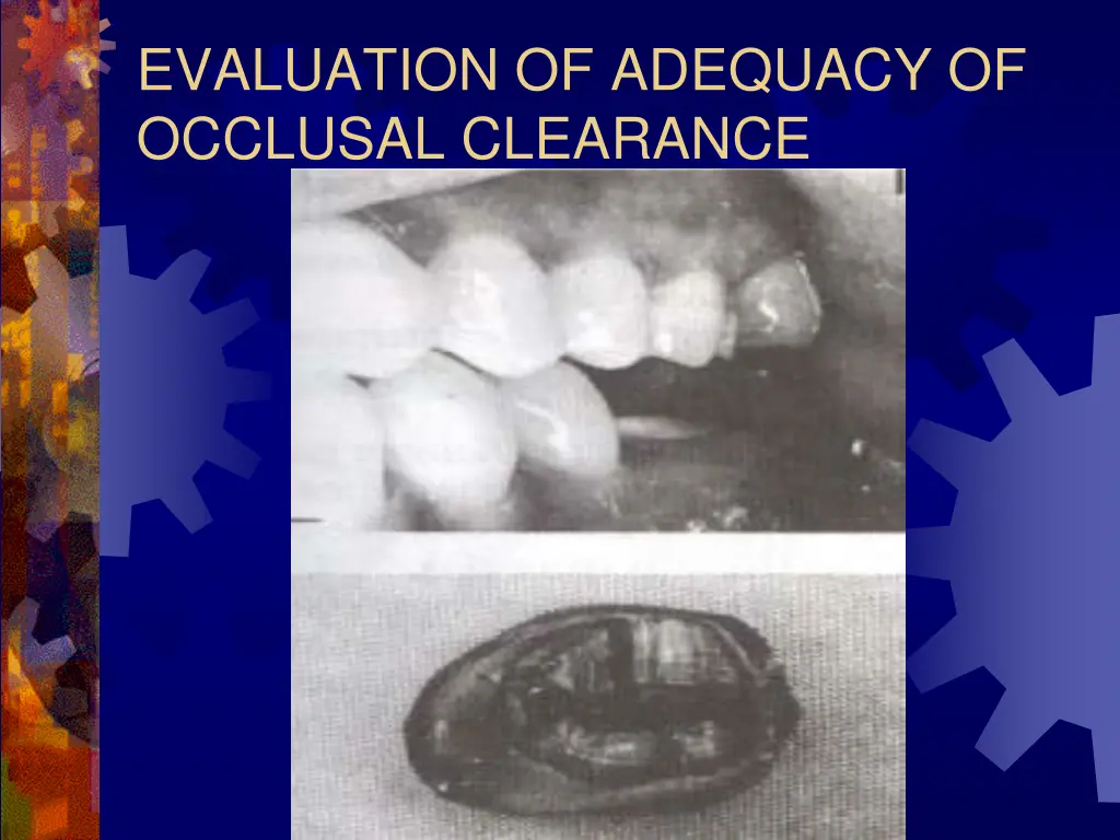 evaluation of adequacy of occlusal clearance