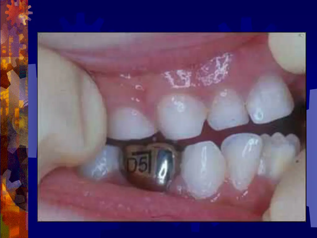 slide11