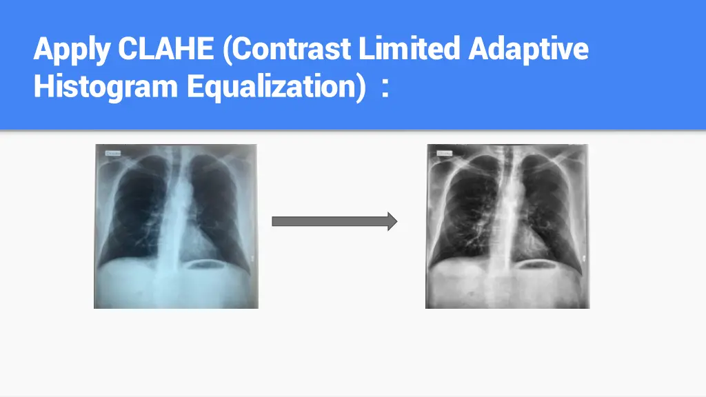 apply clahe contrast limited adaptive histogram