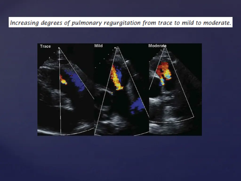 slide6