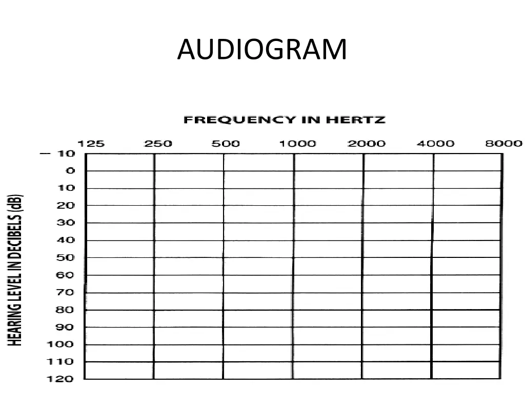 audiogram