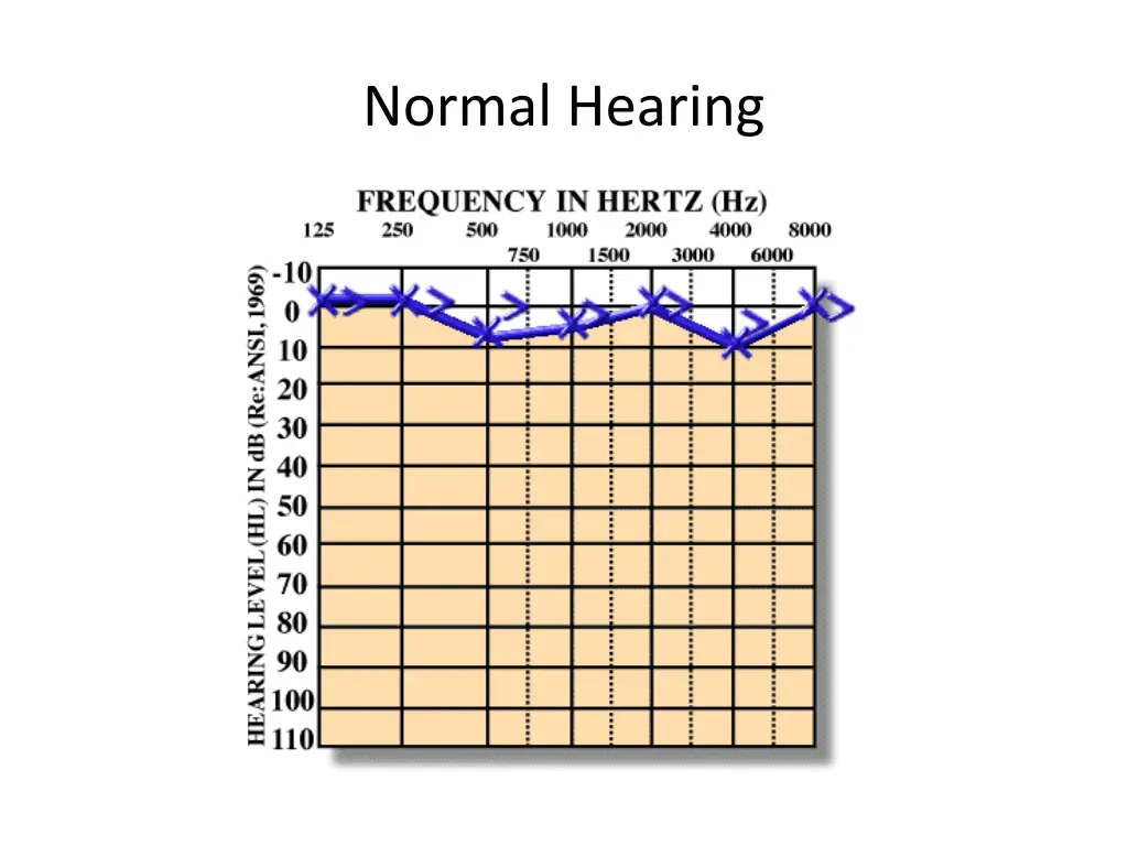 normal hearing