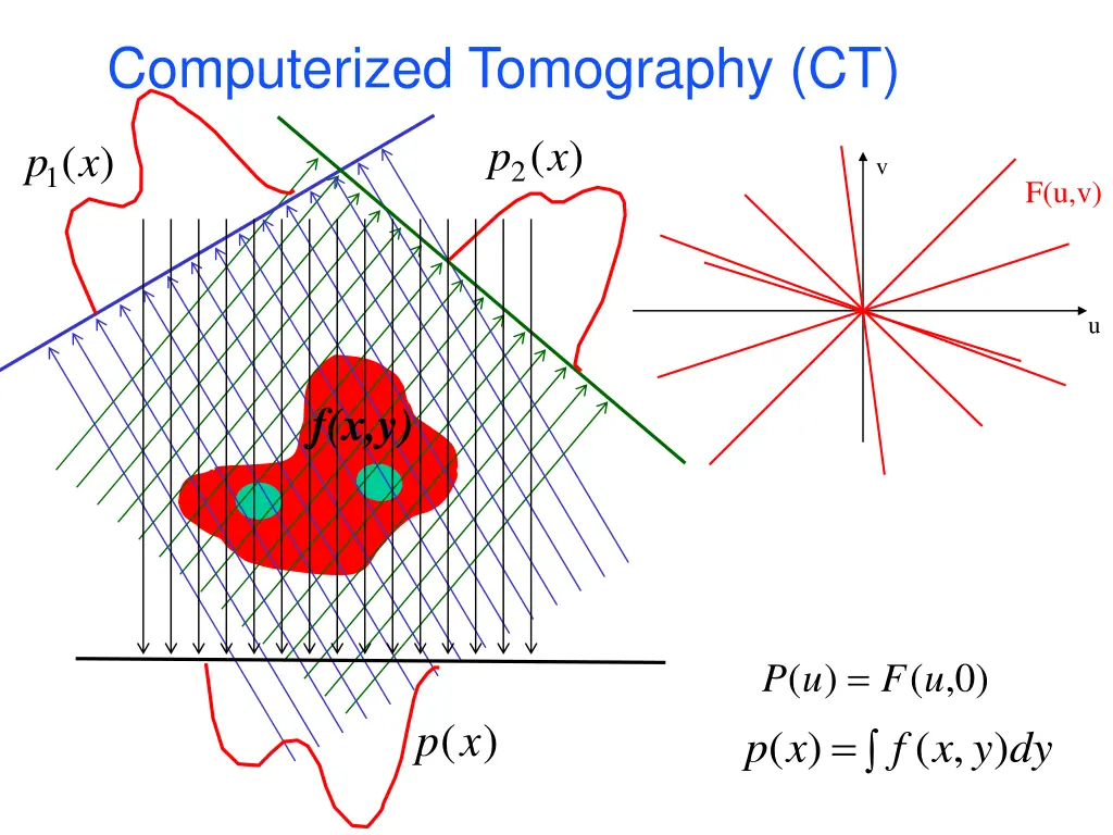 computerized tomography ct