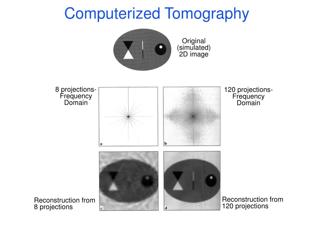 computerized tomography