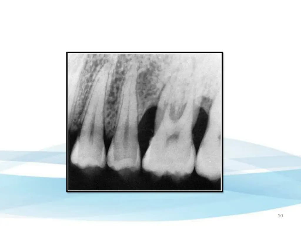slide10