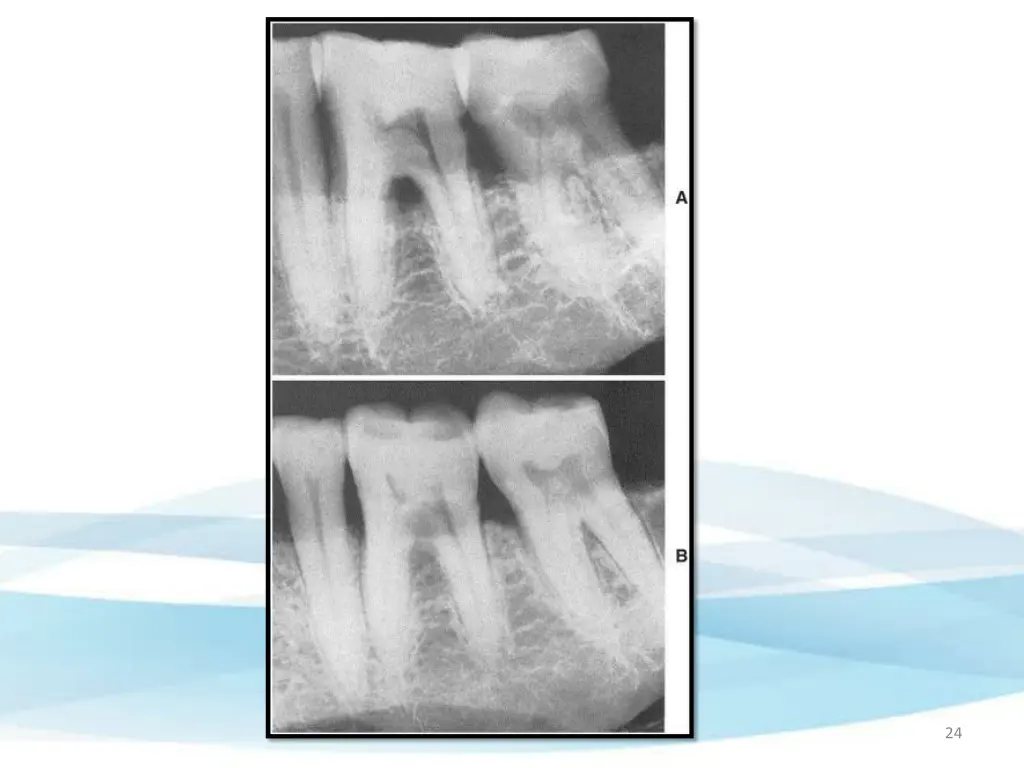 slide24