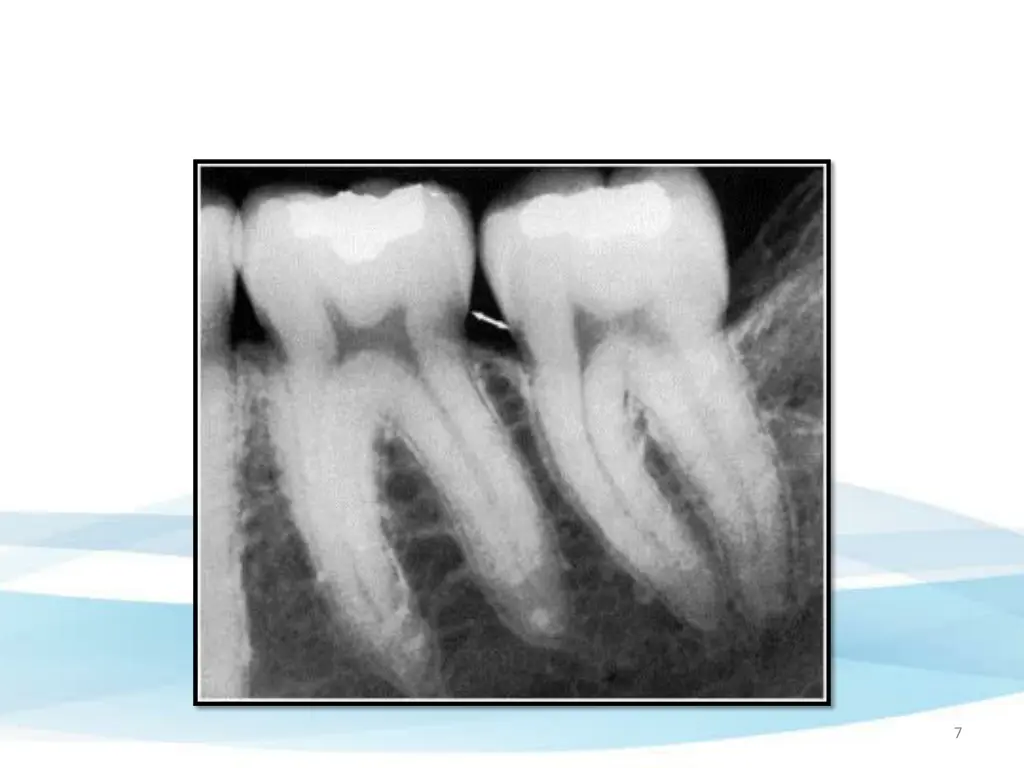 slide7