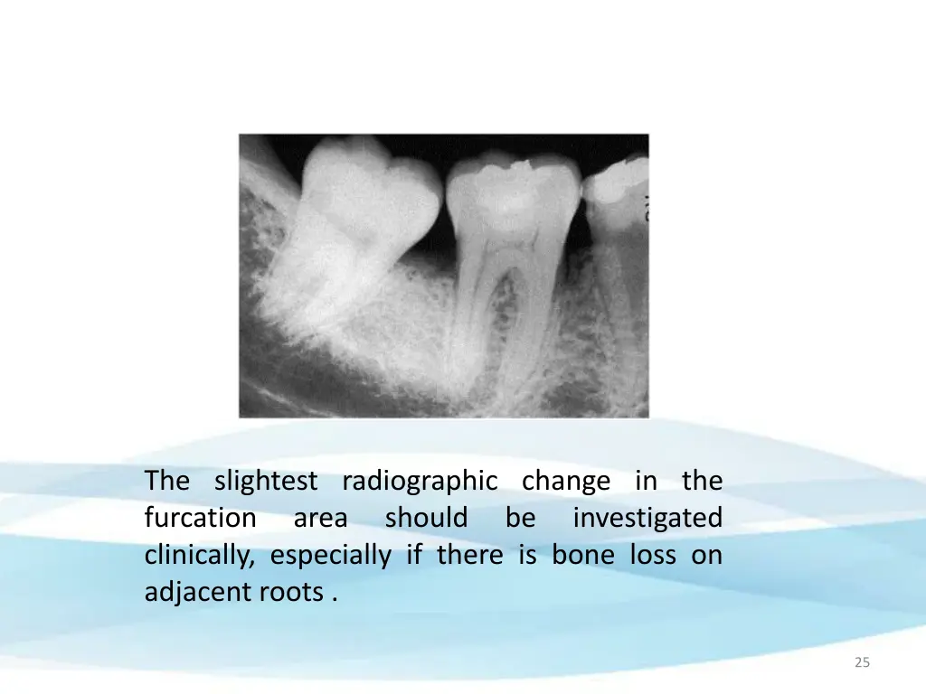 the slightest radiographic change
