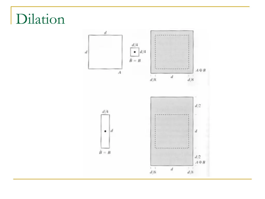 dilation