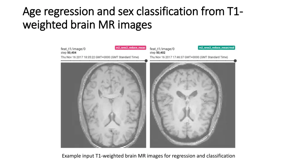 age regression and sex classification from