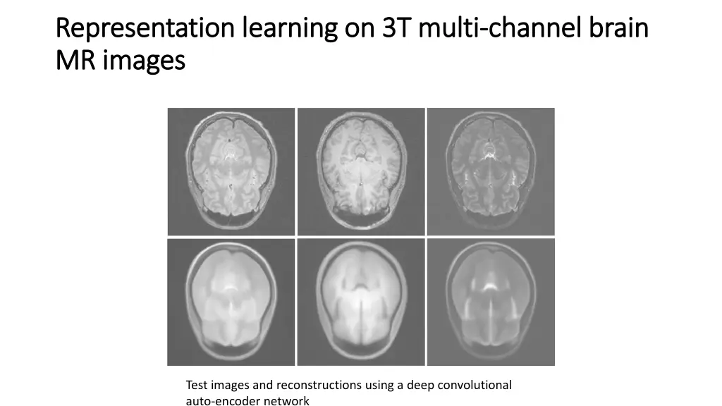 representation learning on 3t multi