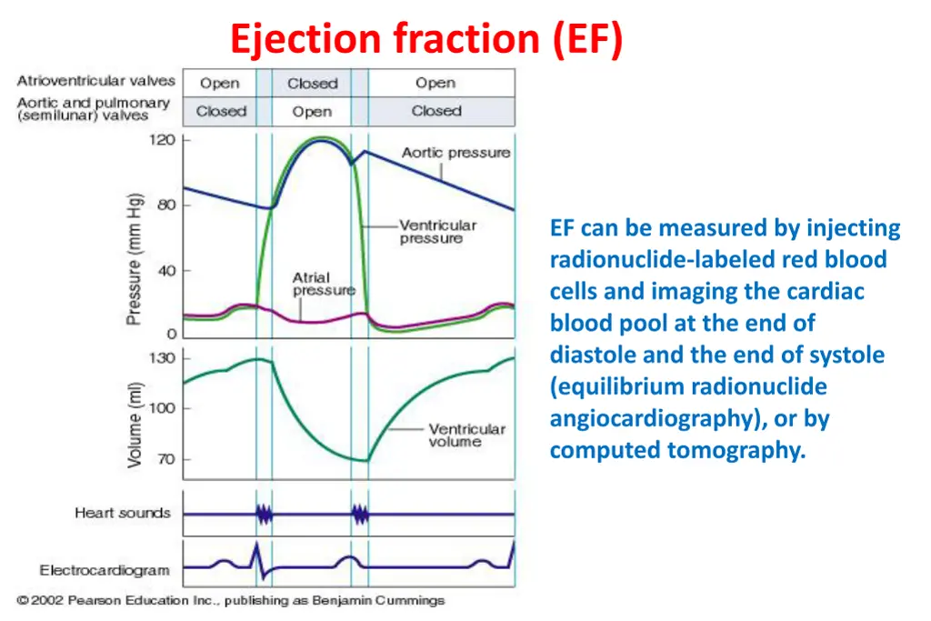 ejection fraction ef 1