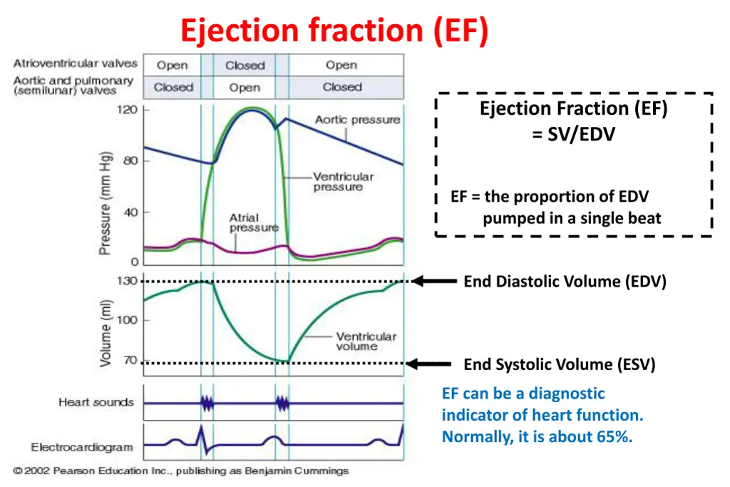 ejection fraction ef