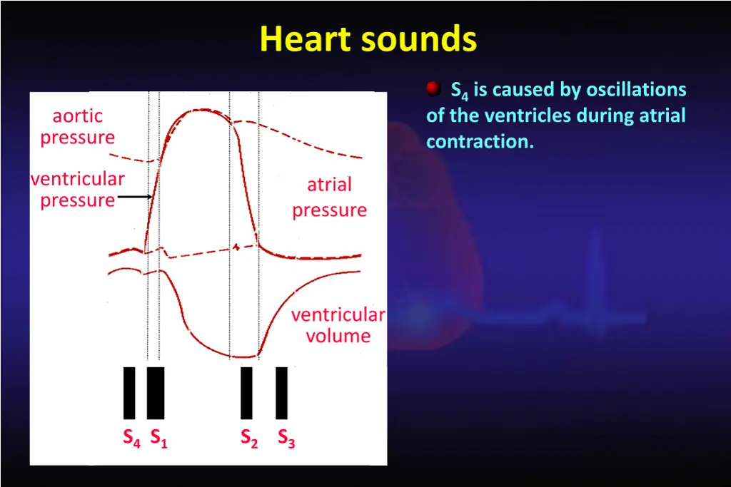 heart sounds 2
