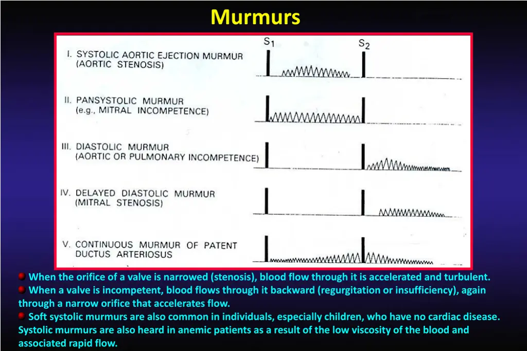 murmurs