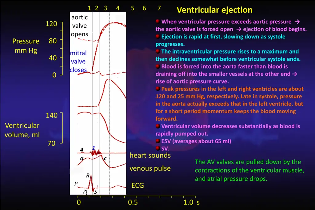 ventricular ejection when ventricular pressure