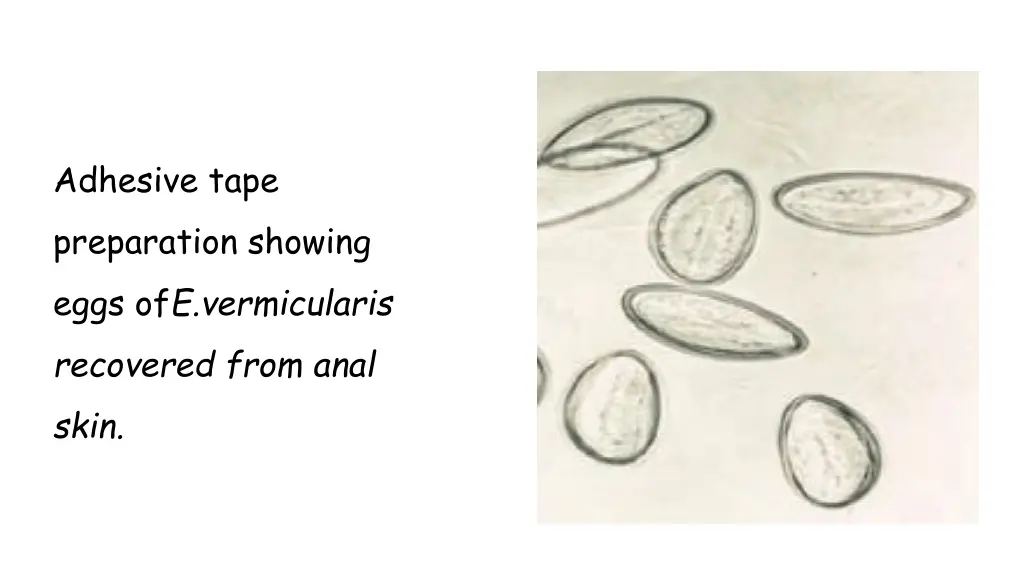 adhesive tape preparation showing eggs