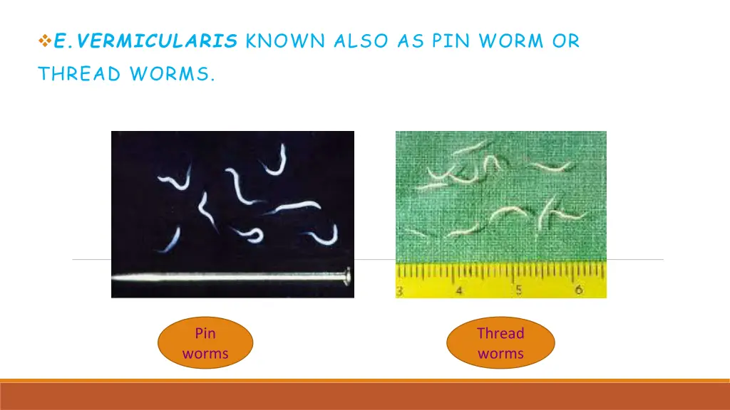 e vermicularis known also as pin worm or thread