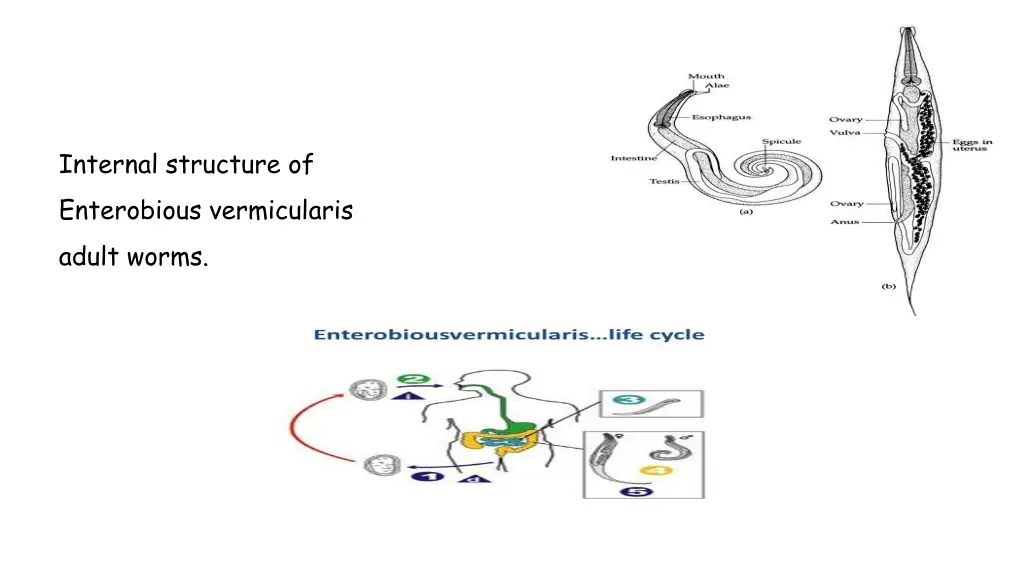internal structure of enterobious vermicularis