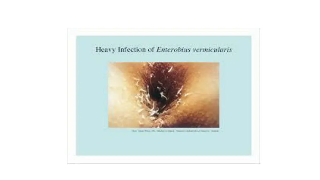 slide10