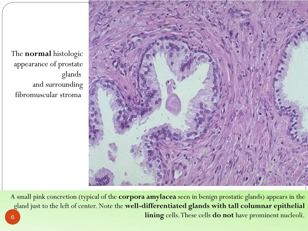 the normal histologic appearance of prostate