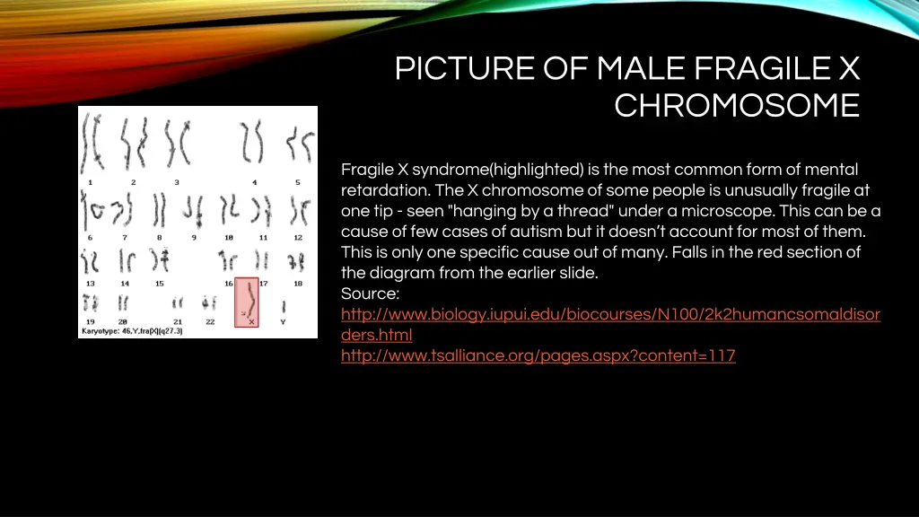 picture of male fragile x chromosome