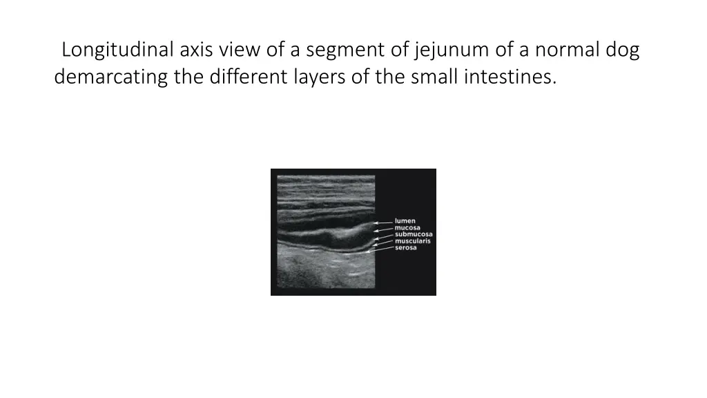 longitudinal axis view of a segment of jejunum