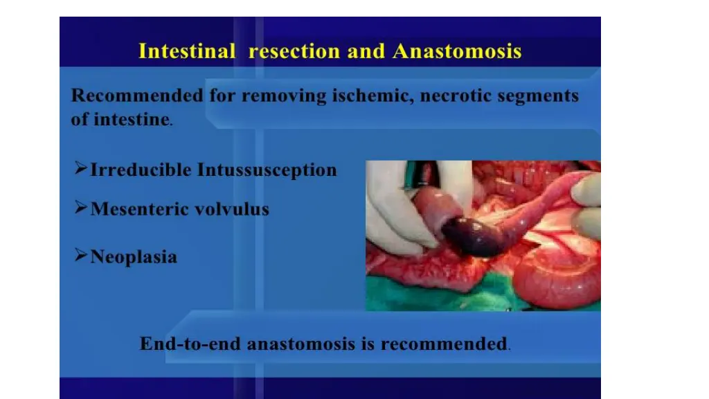 slide14