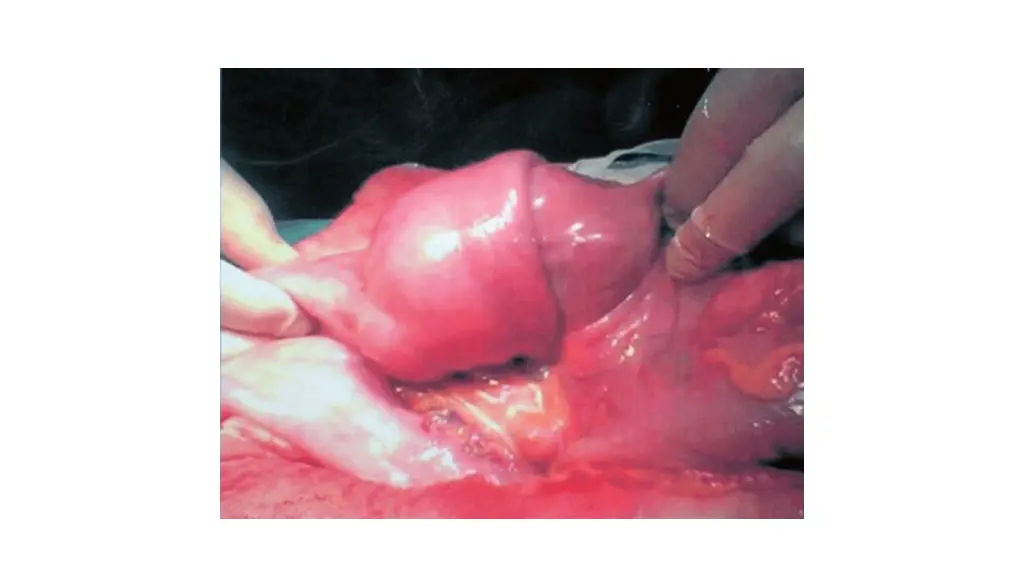 slide9