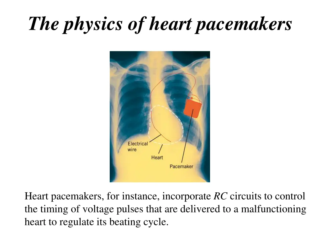 the physics of heart pacemakers