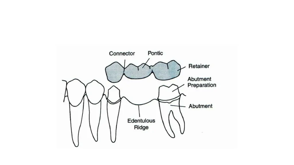 slide12