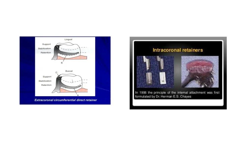 slide14