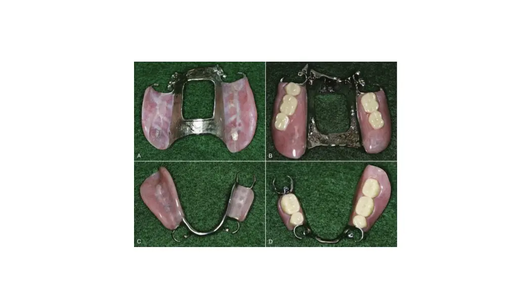 slide21