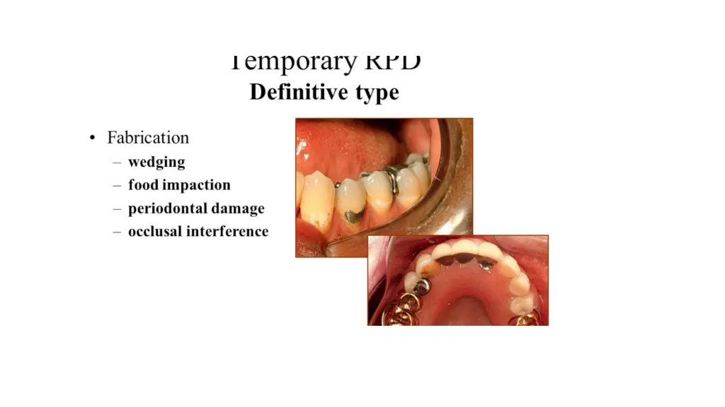 slide23