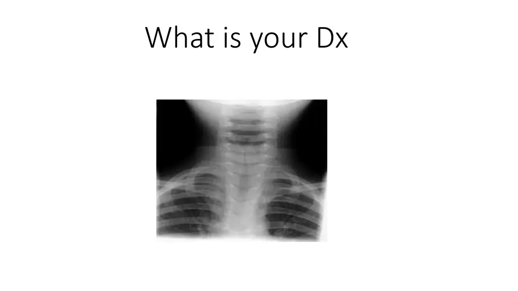 what is your dx
