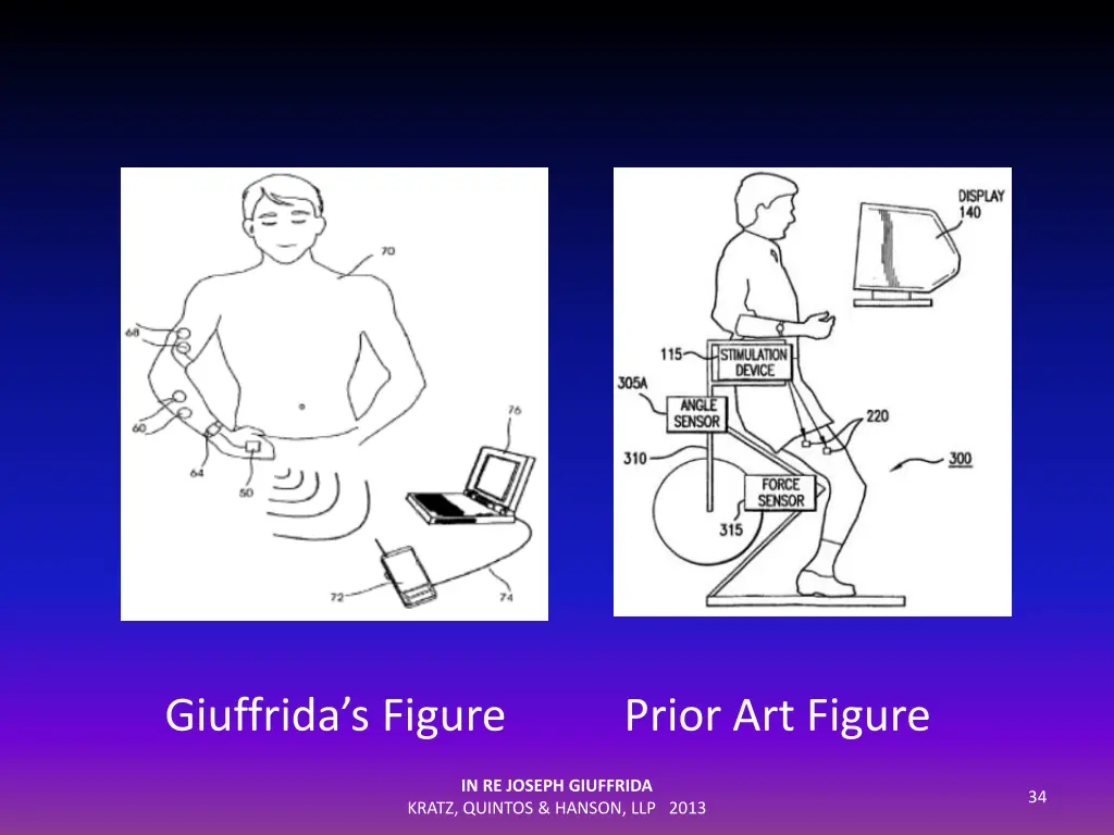 giuffrida s figure