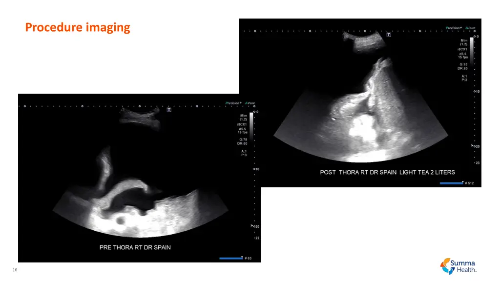 procedure imaging