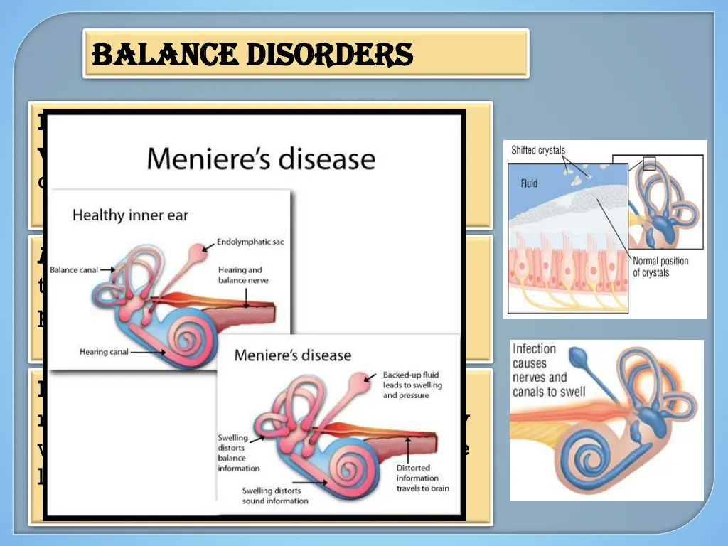 balance disorders balance disorders