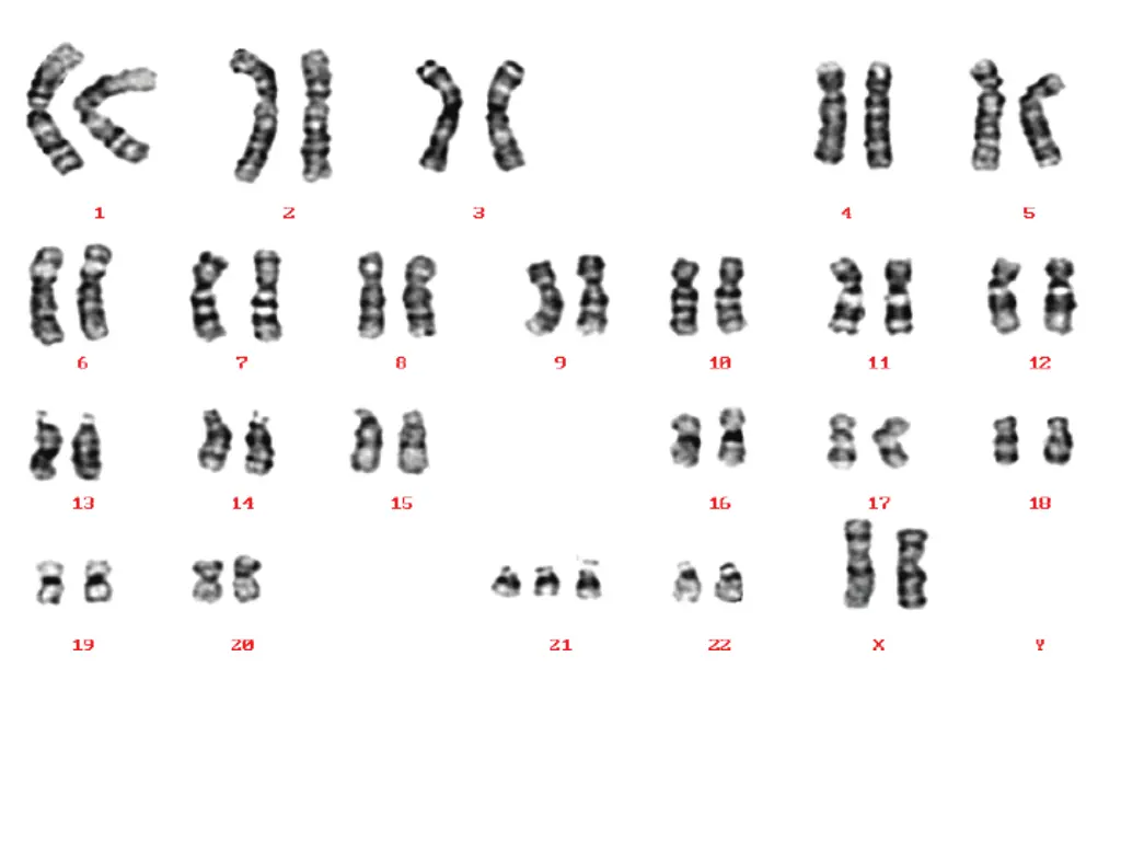 slide12